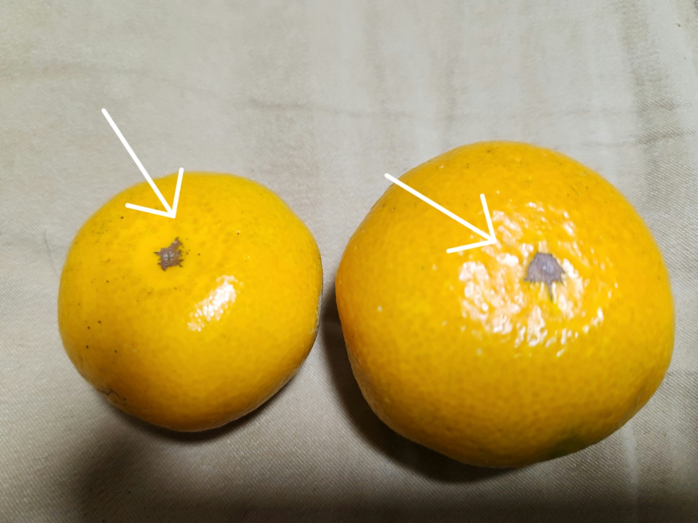 과피에 무슨 병인지