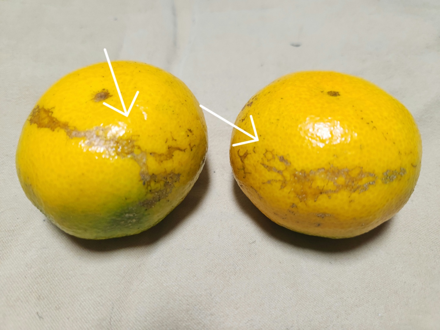 과피에 무슨 병인지